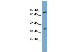 WB Suggested Anti-APEH Antibody Titration:  0. (APEH 抗体  (Middle Region))