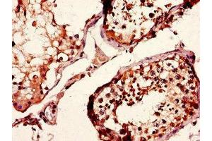 Immunohistochemistry of paraffin-embedded human testis tissue using ABIN7158234 at dilution of 1:100 (CD37 抗体  (AA 109-237))