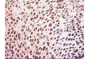 Image no. 11 for anti-Myc Proto-Oncogene protein (MYC) antibody (ABIN1497011) (c-MYC 抗体)