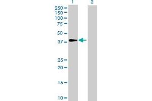 Western Blot analysis of GALM expression in transfected 293T cell line by GALM MaxPab polyclonal antibody. (GALM 抗体  (AA 1-342))