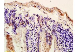 Immunohistochemistry (IHC) image for anti-ATP-Binding Cassette, Sub-Family C (CFTR/MRP), Member 8 (ABCC8) (AA 301-400) antibody (ABIN701980)