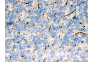 IHC analysis of FCGRT using anti-FCGRT antibody (ABIN3044522).