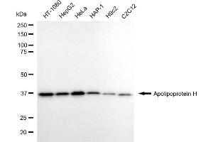 anti-Apolipoprotein H (Beta-2-Glycoprotein I) (APOH) antibody