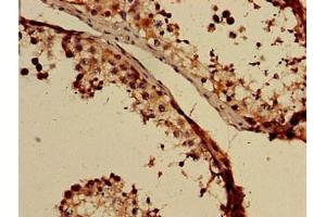 Immunohistochemistry (IHC) image for anti-gamma-aminobutyric Acid (GABA) A Receptor, beta 3 (GABRB3) (AA 328-450) antibody (ABIN7153497)