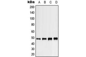 Western blot analysis of Kir3. (KCNJ5 抗体  (C-Term))