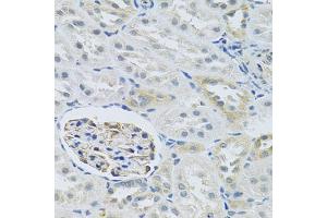 Immunohistochemistry of paraffin-embedded rat kidney using SLC29A1 antibody (ABIN6293826) at dilution of 1:100 (40x lens). (SLC29A1 抗体)