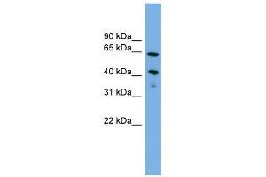 ATP8B2 antibody used at 1 ug/ml to detect target protein. (ATP8B2 抗体  (N-Term))