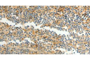 Immunohistochemistry of paraffin-embedded Human tonsil using CFHR1 Polyclonal Antibody at dilution of 1:40 (CFHR1 抗体)