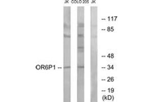 Western blot analysis of extracts from Jurkat/COLO cells, using OR6P1 Antibody. (OR6P1 抗体  (AA 160-209))