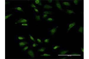 Immunofluorescence of monoclonal antibody to PRKRIP1 on HeLa cell. (PRKRIP1 抗体  (AA 1-184))