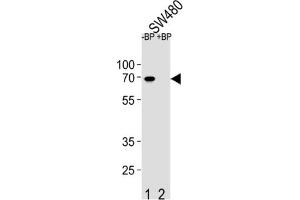 Western Blotting (WB) image for anti-Ets Variant 5 (ETV5) antibody (ABIN2995808) (ETV5 抗体)