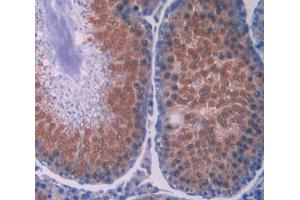 IHC-P analysis of testis tissue, with DAB staining. (Renin 抗体  (AA 144-237))