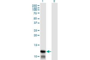 Western Blotting (WB) image for anti-Translocase of Inner Mitochondrial Membrane 8A (TIMM8A) (AA 9-98) antibody (ABIN598643) (TIMM8A/DDP 抗体  (AA 9-98))