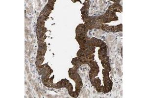 Immunohistochemical staining of human prostate with KRTAP27-1 polyclonal antibody  strong cytoplasmic positivity in glandular cells at 1:200-1:500 dilution. (KRTAP27-1 抗体)
