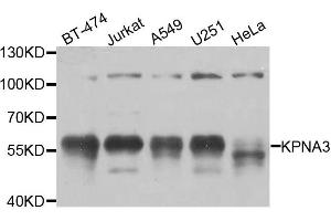 Western blot analysis of extracts of various cell lines, using KPNA3 antibody. (KPNA3 抗体)