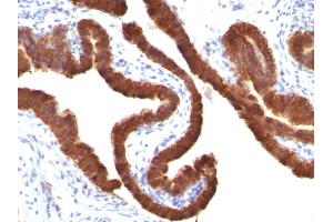 Immunohistochemistry (IHC) image for anti-Keratin 19 (KRT19) antibody (ABIN6939946)