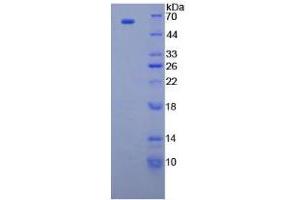 SDS-PAGE analysis of Human CUZD1 Protein. (CUZD1 蛋白)