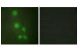 Immunofluorescence analysis of HUVEC cells, using ACL6A antibody. (BAF53A 抗体)