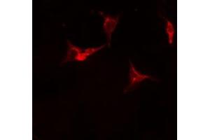 ABIN6275968 staining Hela cells by IF/ICC. (Adenosine A2a Receptor 抗体  (Internal Region))