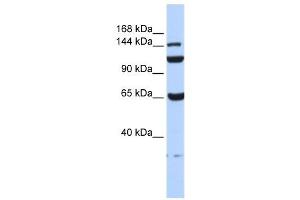 C17ORF57 antibody used at 1 ug/ml to detect target protein. (C17orf57 抗体  (N-Term))