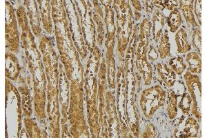 ABIN6278445 at 1/100 staining Mouse kidney tissue by IHC-P. (DEFa3 抗体  (Internal Region))