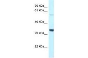 Image no. 1 for anti-Transmembrane Protein 117 (TMEM117) (AA 299-348) antibody (ABIN6747666) (TMEM117 抗体  (AA 299-348))