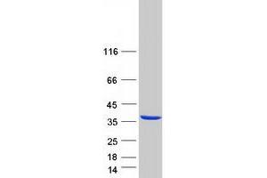 Western Blotting (WB) image for Nitric Oxide Synthase Interacting Protein (NOSIP) protein (Myc-DYKDDDDK Tag) (ABIN2727474)