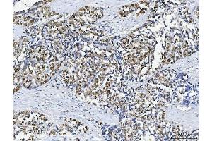 IHC analysis of ABL2 using anti-ABL2 antibody (ABIN4886412). (ABL2 抗体  (AA 1065-1182))