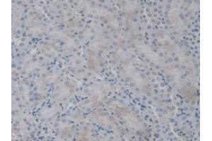 IHC-P analysis of Mouse Kidney Tissue, with DAB staining. (IL1F9 抗体  (AA 5-149))