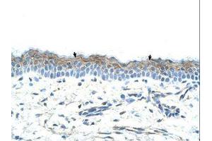 Image no. 1 for anti-serpin Peptidase Inhibitor, Clade B (Ovalbumin), Member 5 (SERPINB5) (AA 151-200) antibody (ABIN203504)