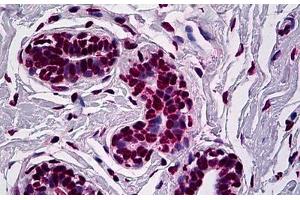 Immunohistochemistry (Formalin-fixed Paraffin-embedded Sections) (IHC (fp)) image for anti-Runt-Related Transcription Factor 1 (RUNX1) (AA 210-311) antibody (ABIN626023)