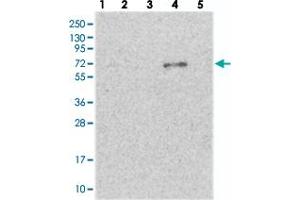 Western blot analysis of Lane 1: RT-4, Lane 2: U-251 MG, Lane 3: Human Plasma, Lane 4: Liver, Lane 5: Tonsil with ETFDH polyclonal antibody . (ETFDH 抗体)