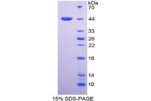 SDS-PAGE analysis of Human TNNT2 Protein. (Cardiac Troponin T2 蛋白)