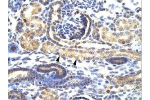 IHC Suggested Anti-SNAI1 Antibody Titration: 4-8ug/mlTissue: Human Kidney, epithelial cells of renal tube (indicated with arrows)Magnification:400X (SNAIL 抗体  (N-Term))