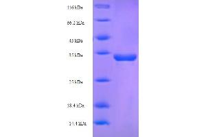 SDS-PAGE (SDS) image for CD8a Molecule (CD8A) (AA 26-189) protein (His-SUMO Tag) (ABIN5709255)
