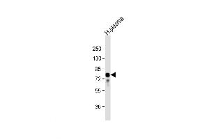 Western Blot at 1:32000 dilution + human plasma lysate Lysates/proteins at 20 ug per lane. (Vitronectin 抗体  (N-Term))