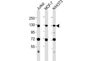 All lanes : Anti-MCM2 Antibody (C-term) at 1:2000 dilution Lane 1: Jurkat whole cell lysates Lane 2: MCF-7 whole cell lysates Lane 3: NIH/3T3 whole cell lysates Lysates/proteins at 20 μg per lane. (MCM2 抗体  (C-Term))