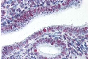 Human Uterus (formalin-fixed, paraffin-embedded) stained with HSF1 antibody ABIN337399 at 5 ug/ml followed by biotinylated goat anti-rabbit IgG secondary antibody ABIN481713, alkaline phosphatase-streptavidin and chromogen. (HSF1 抗体)
