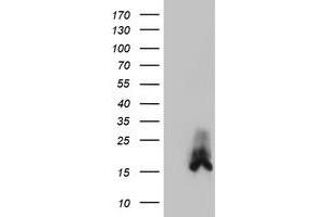 HEK293T cells were transfected with the pCMV6-ENTRY control (Left lane) or pCMV6-ENTRY DUSP23 (Right lane) cDNA for 48 hrs and lysed. (DUSP23 抗体)
