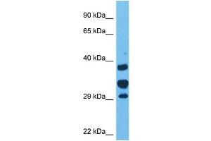 Western Blotting (WB) image for anti-Acidic (Leucine-Rich) Nuclear phosphoprotein 32 Family, Member E (ANP32E) (Middle Region) antibody (ABIN2782591)