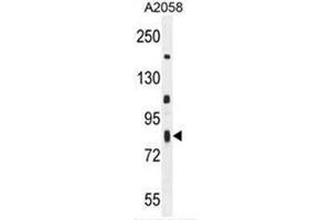 C6orf70 Antibody (Center) western blot analysis in A2058 cell line lysates (35µg/lane). (C6orf70 抗体  (Middle Region))