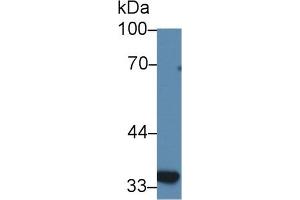 Detection of SLC30A8 in Human BXPC3 cell lysate using Polyclonal Antibody to Solute Carrier Family 30 Member 8 (SLC30A8) (SLC30A8 抗体  (AA 263-369))