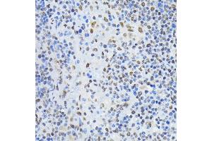 Immunohistochemistry of paraffin-embedded rat spleen using PTBP1 antibody  at dilution of 1:100 (40x lens). (PTBP1 抗体  (AA 1-290))