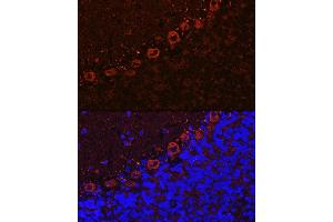 Immunofluorescence analysis of rat brain cells using  Rabbit pAb (ABIN6131182, ABIN6136830, ABIN6136831 and ABIN6222940) at dilution of 1:100 (40x lens).