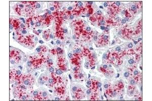 Immunohistochemistry (IHC) image for anti-Ribonuclease/angiogenin Inhibitor 1 (RNH1) (AA 7-461) antibody (ABIN400852) (RNH1 抗体  (AA 7-461))