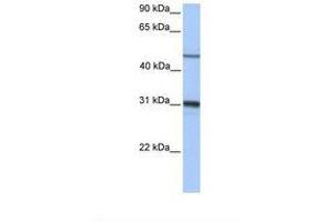 Image no. 1 for anti-Epoxide Hydrolase 1, Microsomal (Xenobiotic) (EPHX1) (AA 182-231) antibody (ABIN6738923) (EPHX1 抗体  (AA 182-231))