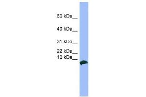 VIP antibody used at 1 ug/ml to detect target protein. (Vip 抗体  (Middle Region))