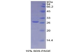 SDS-PAGE of Protein Standard from the Kit  (Highly purified E. (CD25 ELISA 试剂盒)