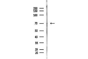 Western blot analysis of lysates from Hela cells(heat-shock, 45 min treatment), using CDC7 Antibody at 1/1000 dilution.