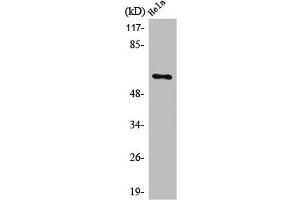 Western Blot analysis of COLO205 cells using PLK-5 Polyclonal Antibody (PLK5 抗体  (Internal Region))